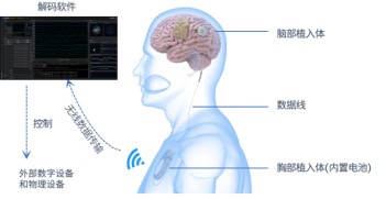 脑虎科技“三全”脑机接口系统